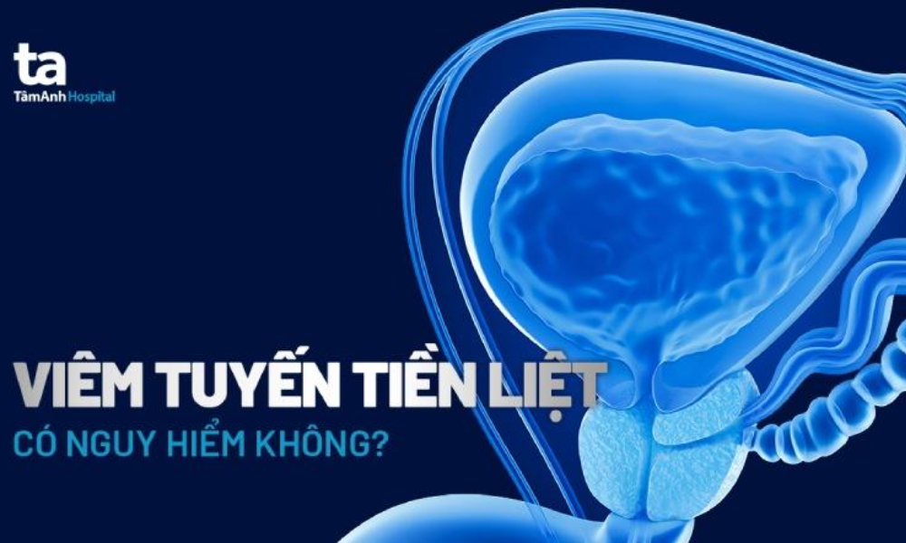 Tuyến tiền liệt nằm ngay dưới bàng quang và bao quanh niệu đạo